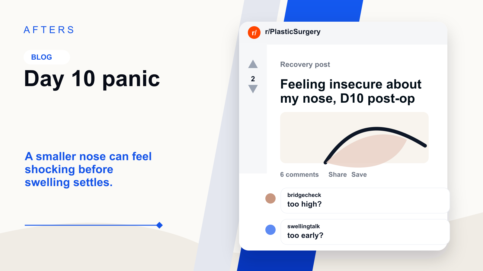 Afters cover showing a day 10 rhinoplasty recovery panic question with a timeline visual