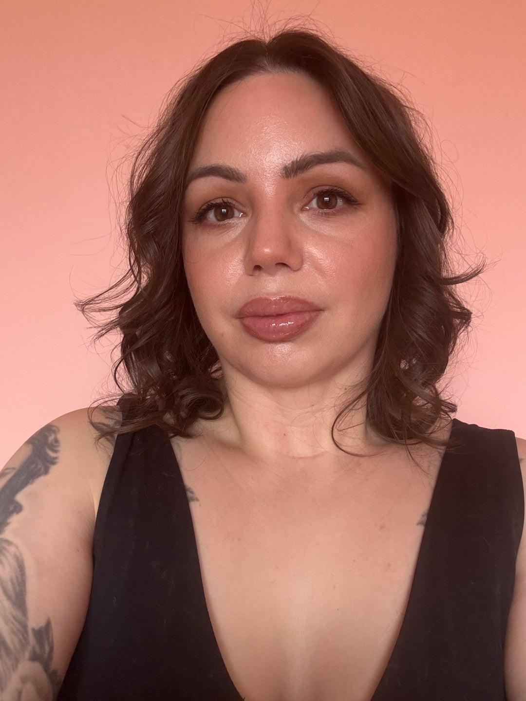 Preoperative lower-eyelid photo with makeup