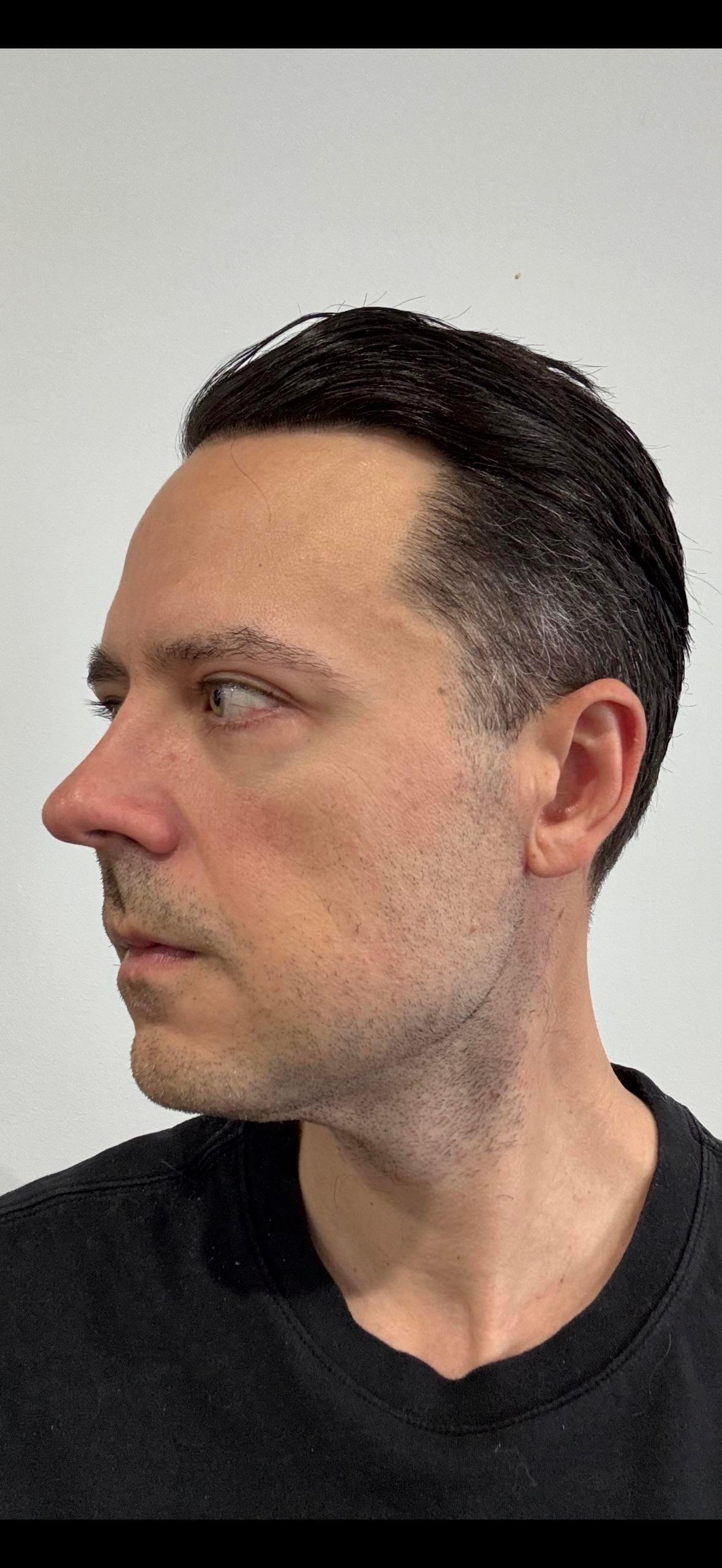 Five-month profile photograph shared by the Reddit poster