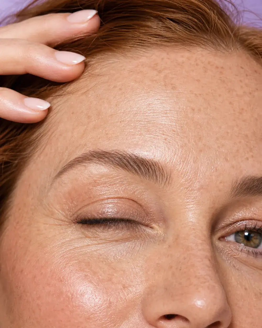 Eyelid Surgery before and after