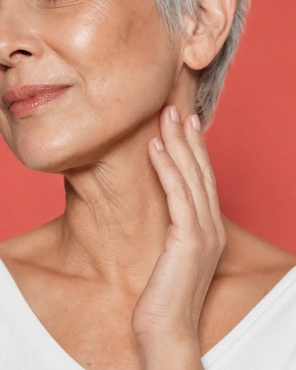 Neck Lift before and after