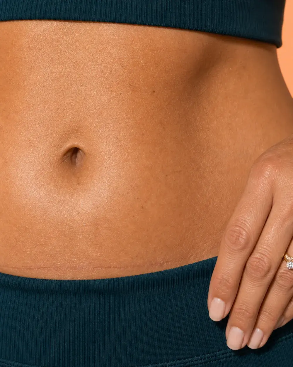 Tummy before and after