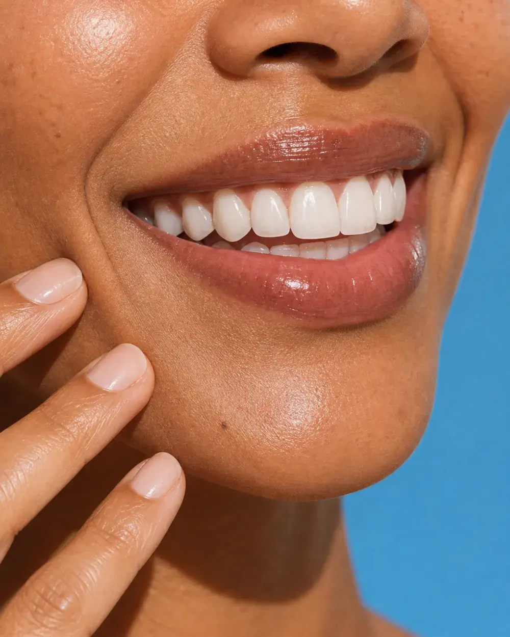 Veneers before and after