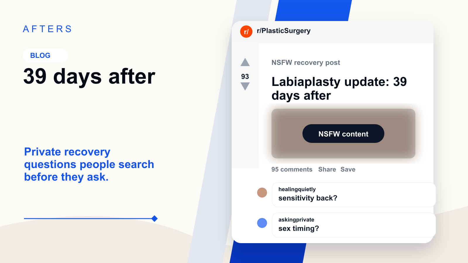 Labiaplasty Recovery at 39 Days: The Questions People Are Too Embarrassed to Ask