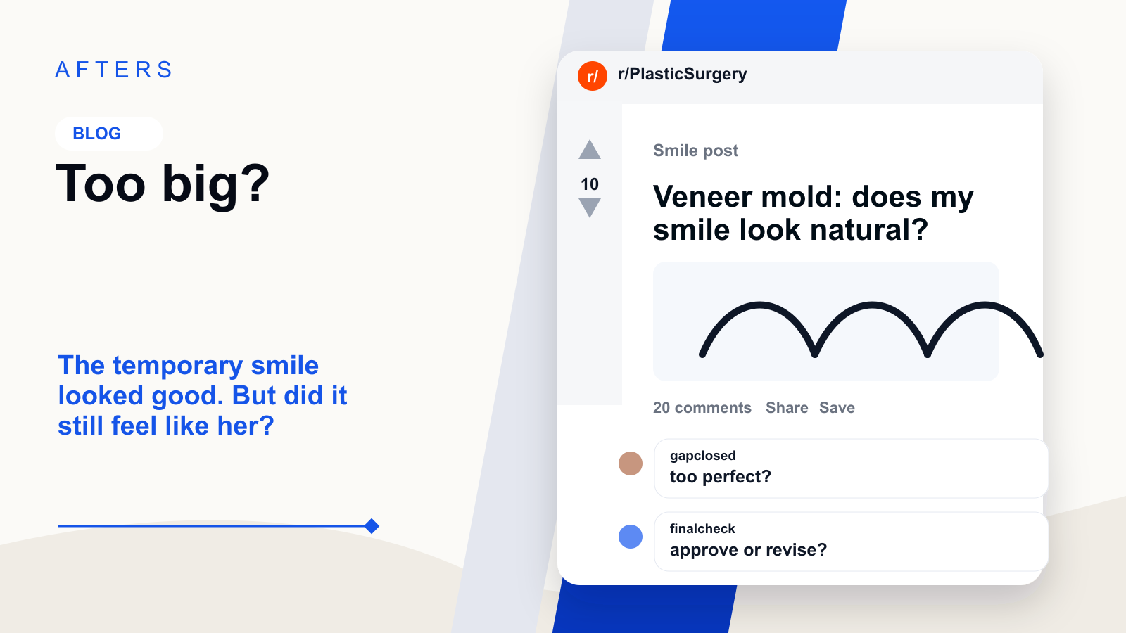 If Your Temporary Veneers Feel Too Big, Read This Before You Approve the Finals