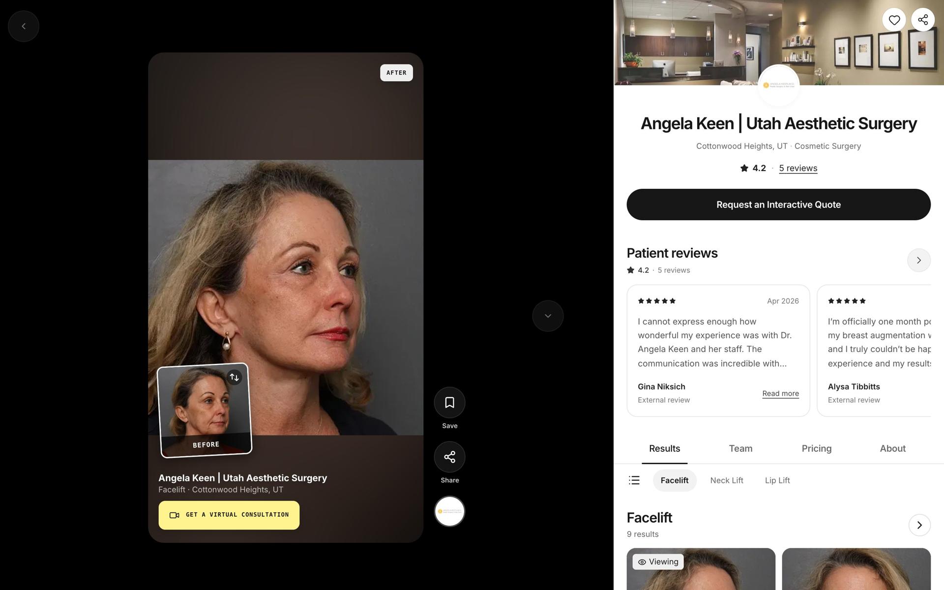 Angela Keen | Utah Aesthetic Surgery’s page on Afters: a facelift result full screen, beside the practice’s reviews and results