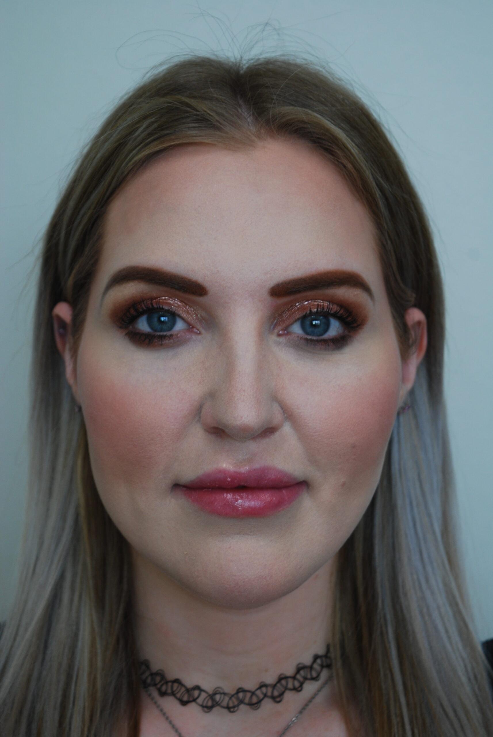 John R. Bennett, MD rhinoplasty after — Draper, UT