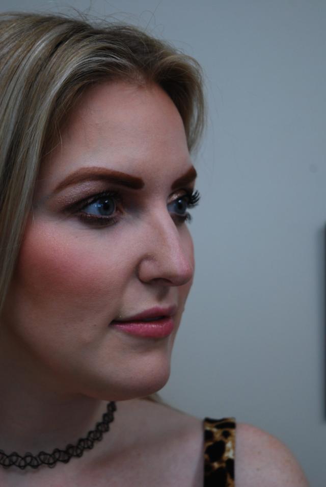 Functional Rhinoplasty before at John R. Bennett, MD in Draper, UT