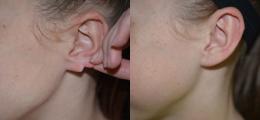 Chatham Facial Plastic Surgery & Medical Skin Care, Chatham Donn R MD result — St Matthews, KY