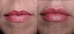 Chatham Facial Plastic Surgery & Medical Skin Care, Chatham Donn R MD result — St Matthews, KY