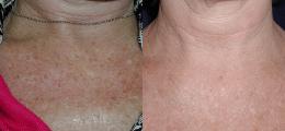 Chatham Facial Plastic Surgery & Medical Skin Care, Chatham Donn R MD result — St Matthews, KY