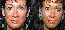 Chatham Facial Plastic Surgery & Medical Skin Care, Chatham Donn R MD result — St Matthews, KY