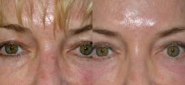 Chatham Facial Plastic Surgery & Medical Skin Care, Chatham Donn R MD result — St Matthews, KY