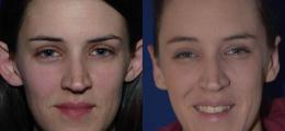 Chatham Facial Plastic Surgery & Medical Skin Care, Chatham Donn R MD result — St Matthews, KY
