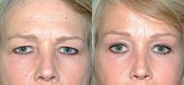 Chatham Facial Plastic Surgery & Medical Skin Care, Chatham Donn R MD result — St Matthews, KY