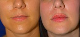 Chatham Facial Plastic Surgery & Medical Skin Care, Chatham Donn R MD result — St Matthews, KY