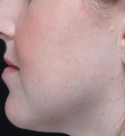 Moy, Fincher, Chipps Facial Plastics & Dermatology - Beverly Hills provider photo