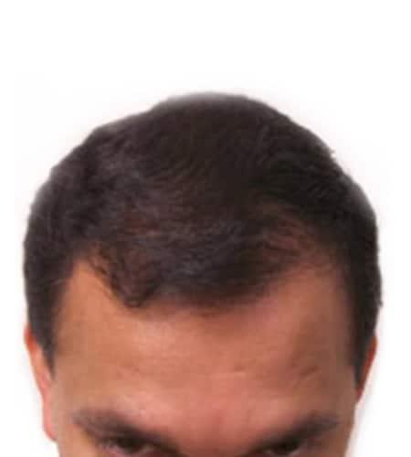 Moy, Fincher, Chipps Facial Plastics & Dermatology - Beverly Hills after — Beverly Hills, CA