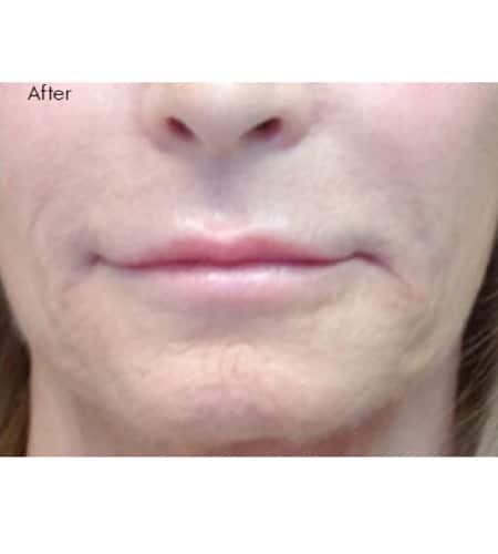 Moy, Fincher, Chipps Facial Plastics & Dermatology - Beverly Hills provider photo