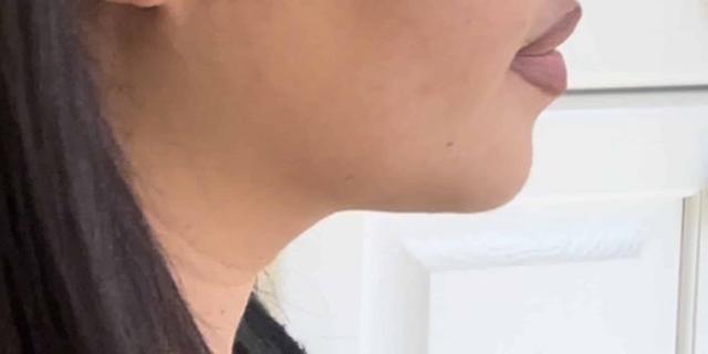 Moy, Fincher, Chipps Facial Plastics & Dermatology - Beverly Hills provider photo