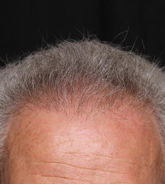 Moy, Fincher, Chipps Facial Plastics & Dermatology - Beverly Hills after — Beverly Hills, CA