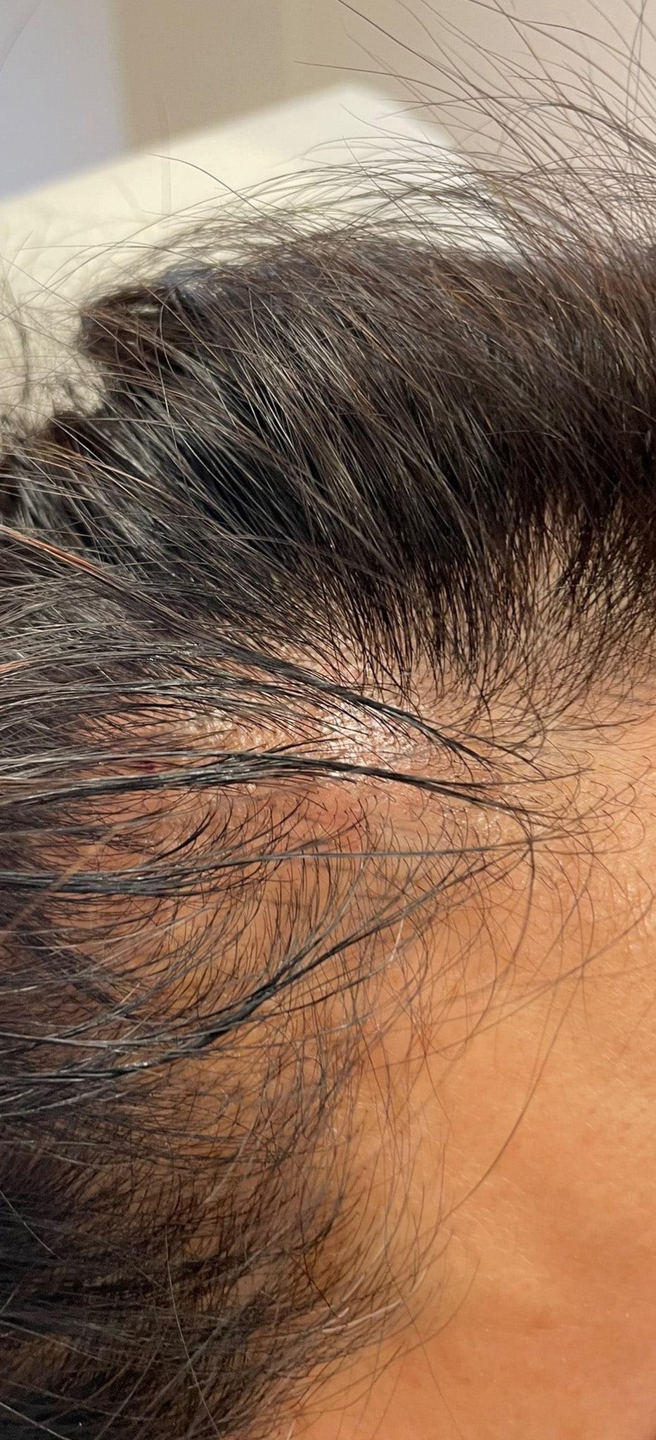 Moy, Fincher, Chipps Facial Plastics & Dermatology - Beverly Hills after — Beverly Hills, CA