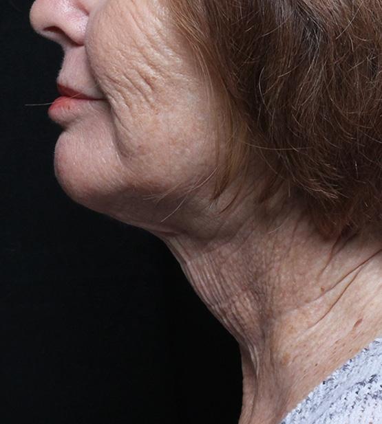 Moy, Fincher, Chipps Facial Plastics & Dermatology - Beverly Hills provider photo