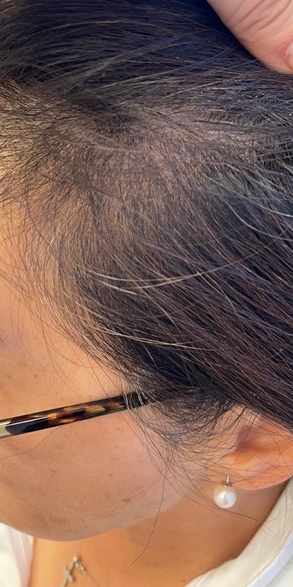 Moy, Fincher, Chipps Facial Plastics & Dermatology - Beverly Hills after — Beverly Hills, CA