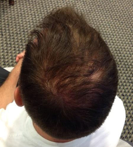 Moy, Fincher, Chipps Facial Plastics & Dermatology - Beverly Hills after — Beverly Hills, CA
