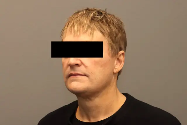 Facelift after at Couture Dermatology & Plastic Surgery in Las Vegas, NV