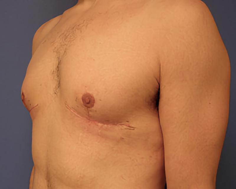 Esana Plastic Surgery Center & MedSpa after — Guilford, CT