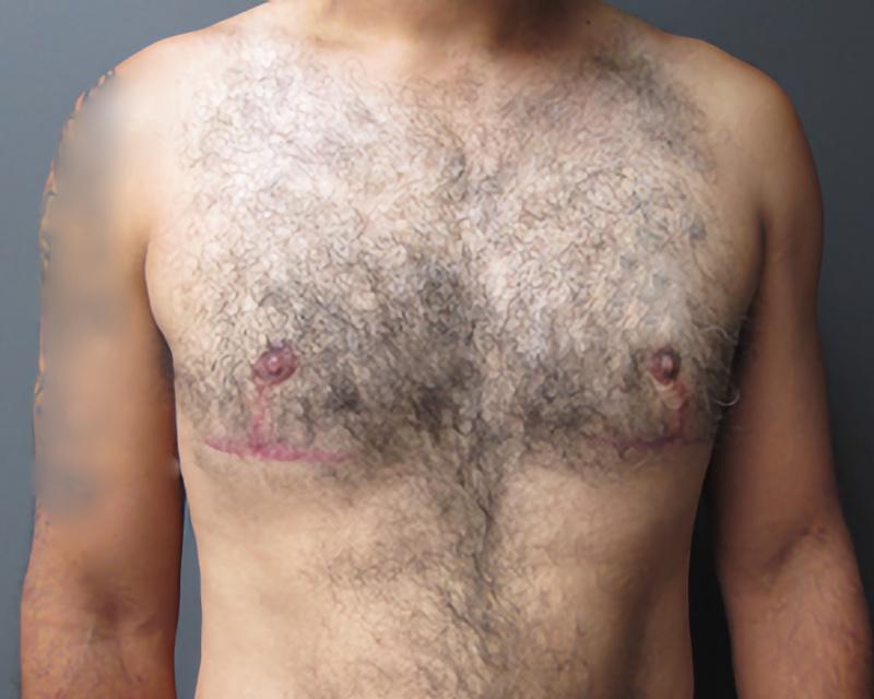 Esana Plastic Surgery Center & MedSpa after — Guilford, CT