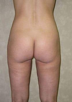 Louis L. Strock M.D., P.A. after — Fort Worth, TX