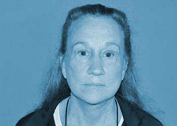 The Clinic of Facial Plastic Surgery facelift after — Buffalo, NY