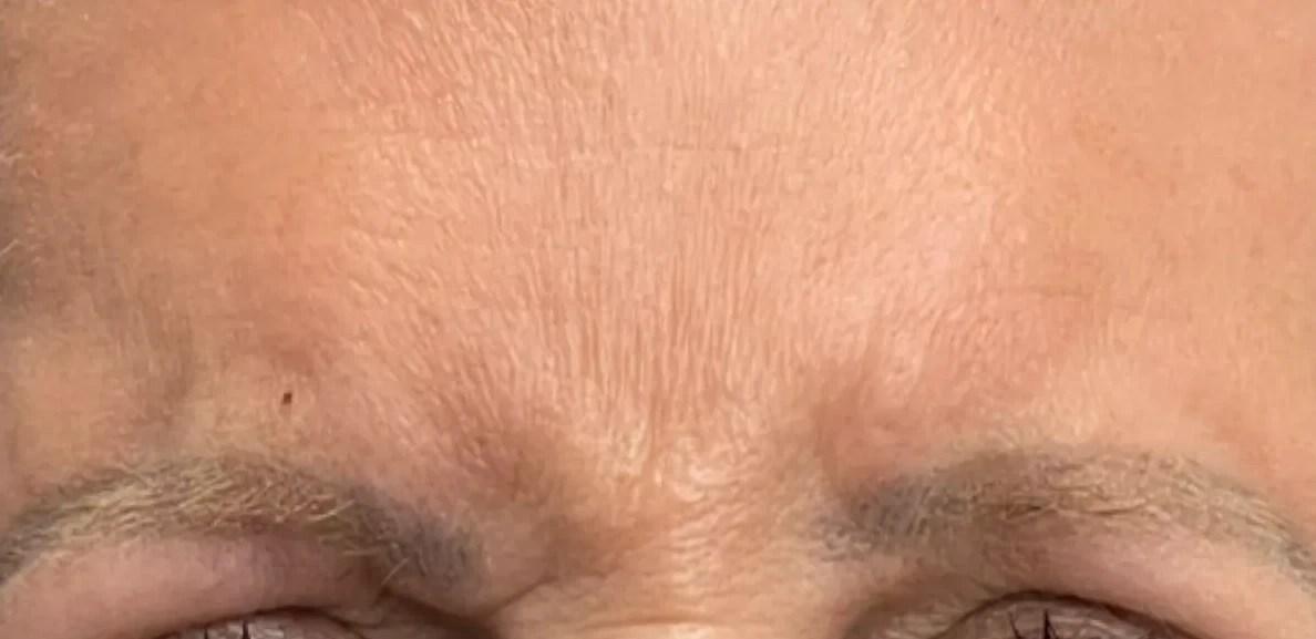 Tahira Aesthetics and Lasers result — Sugar Land, TX