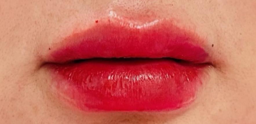 Tahira Aesthetics and Lasers result — Sugar Land, TX
