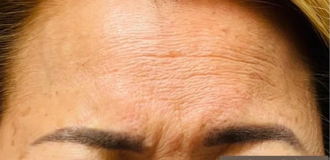 Tahira Aesthetics and Lasers result — Sugar Land, TX