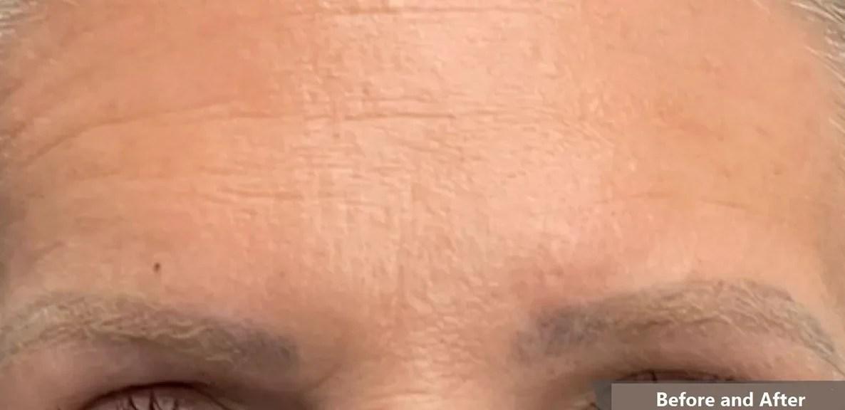 Tahira Aesthetics and Lasers result — Sugar Land, TX