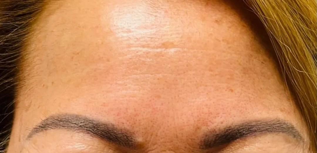 Tahira Aesthetics and Lasers result — Sugar Land, TX