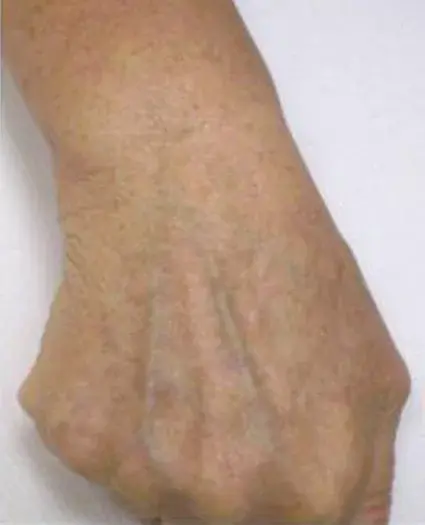 Dr. Iliana Sweis - North Shore Center for Plastic Surgery after — Northbrook, IL