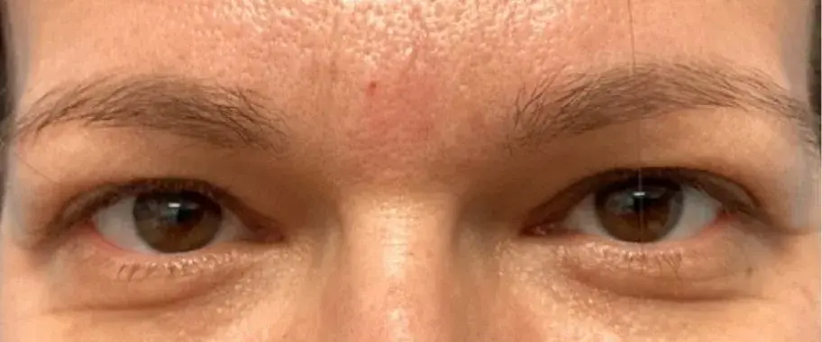 Dr. Iliana Sweis - North Shore Center for Plastic Surgery result — Northbrook, IL