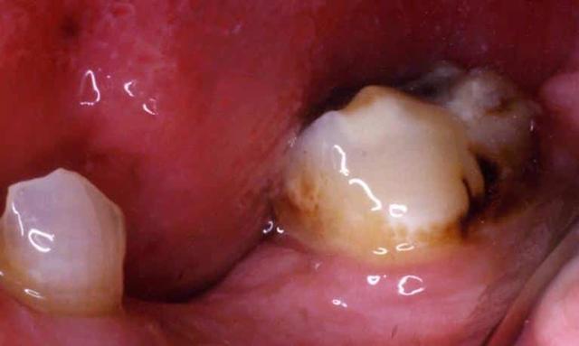 Smile Makeover before at Matt McGee Family and Cosmetic Dentistry in Nashville, TN