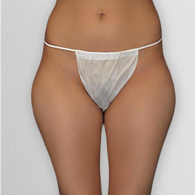 Liposuction before at Alpine Plastic Surgery in Ogden, UT