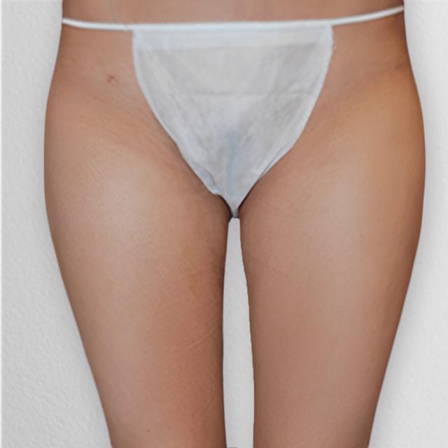 Liposuction after at Alpine Plastic Surgery in Ogden, UT