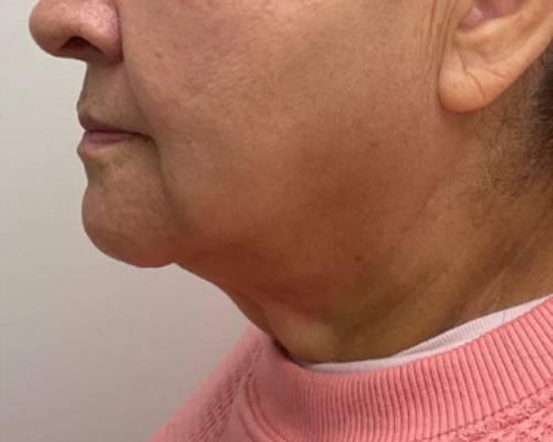 Skinzone Laser & Cosmetic Surgery: Dr. Hannah Vu, MD provider photo