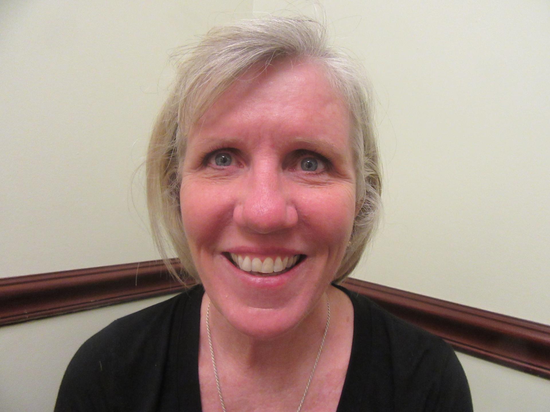 Plastic Surgery of Palm Beach facelift after — West Palm Beach, FL