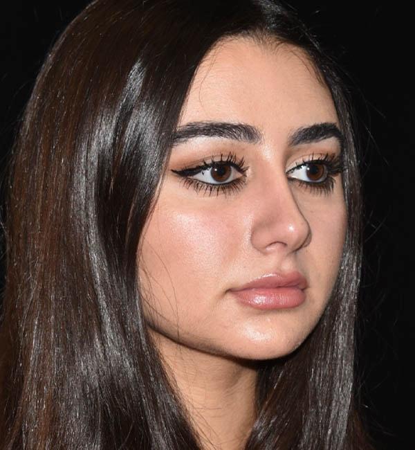 Gary Motykie, MD rhinoplasty after — West Hollywood, CA