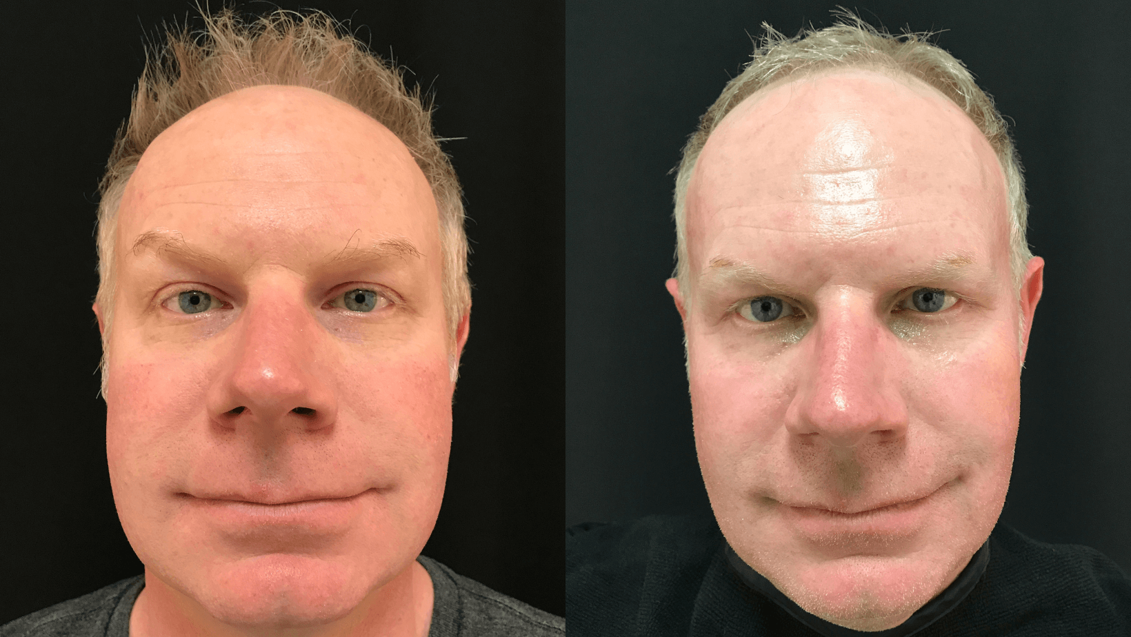 Milwaukee Laser & Body Aesthetics result — Brookfield, WI