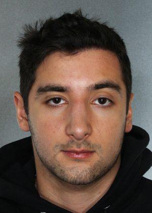 New York Plastic Surgery rhinoplasty after — New York, NY