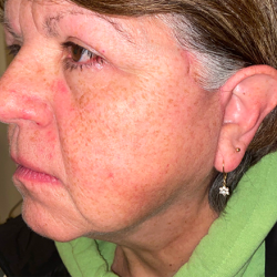 Facial Plastic Surgeon Winnetka: Dr. Paul Phelps provider photo